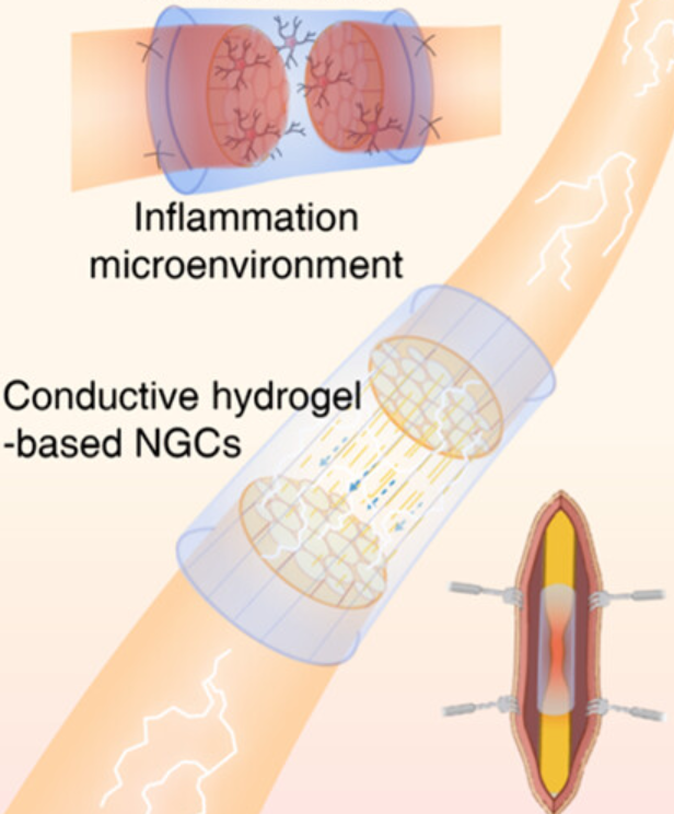 Conductive hydrogels with topographical geometry and mechanical robustness for enhanced peripheral nerve regeneration