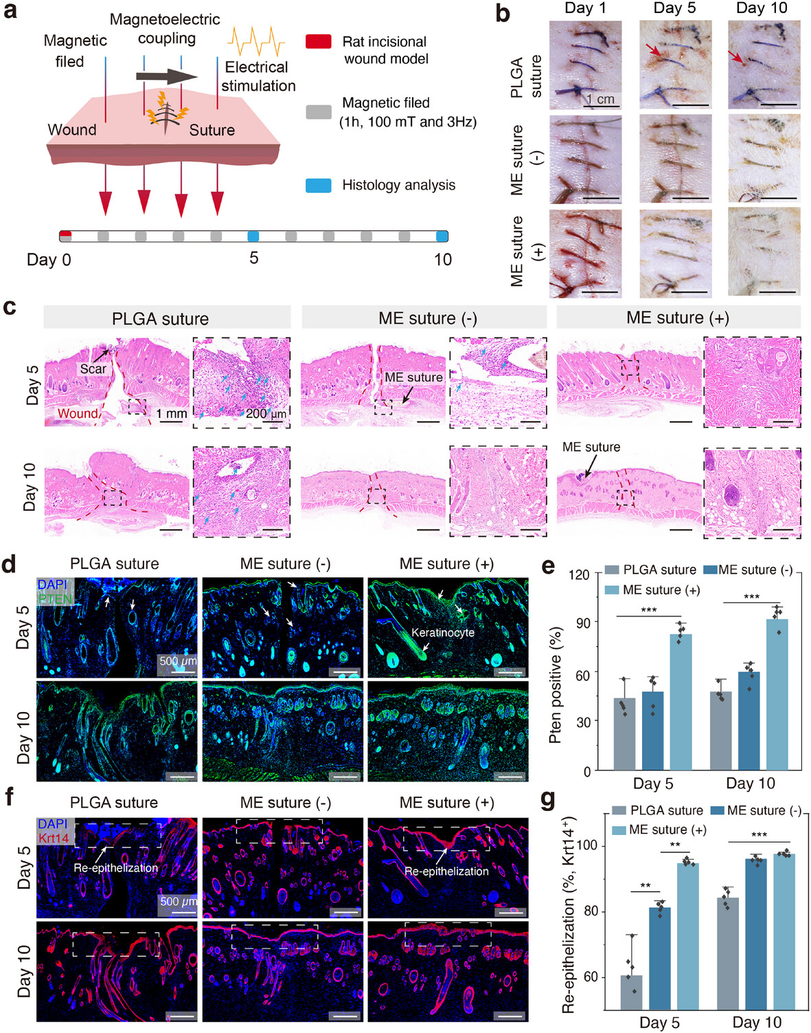Mechanically-compliant magnetoelectric sutures for spatiotemporally programmable wound management